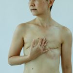 Mulher com cicatrizes de cirurgia toca a própria mama em um estúdio de fundo branco.