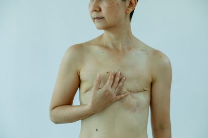 Mulher com cicatrizes de cirurgia toca a própria mama em um estúdio de fundo branco.